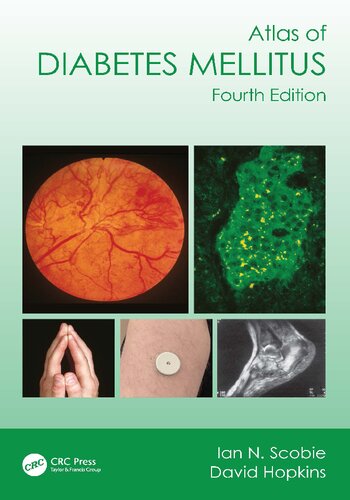 Atlas of Diabetes Mellitus (PDF/EPUB Version)

