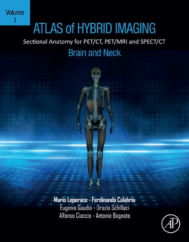 Atlas of Hybrid Imaging Sectional Anatomy for PET/CT, PET/MRI and SPECT/CT Vol. 1: Brain and Neck: Sectional Anatomy for PET/CT, PET/MRI and SPECT/CT (PDF/EPUB Version)
