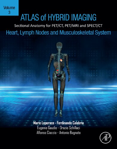 Atlas of Hybrid Imaging Sectional Anatomy for PET/CT, PET/MRI and SPECT/CT Vol. 3: Heart, Lymph Node and Musculoskeletal System: Sectional Anatomy for PET/CT, PET/MRI and SPECT/CT (PDF/EPUB Version)
