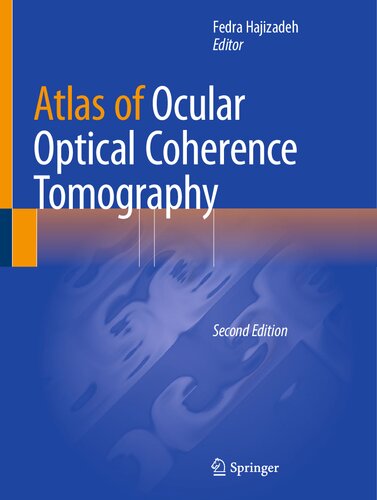 Atlas of Ocular Optical Coherence Tomography (PDF/EPUB Version)
