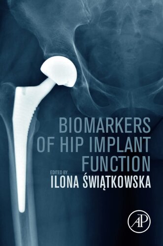 Biomarkers of Hip Implant Function: Diagnostic Modalities to Prevent Chronic Periprosthetic Joint Infection and Implant Failure (PDF/EPUB Version)
