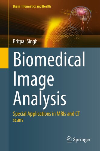 Biomedical Image Analysis: Special Applications in MRIs and CT scans (PDF/EPUB Version)