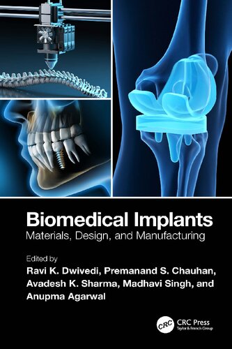 Biomedical Implants. Materials, Design, and Manufacturing (PDF/EPUB Version)