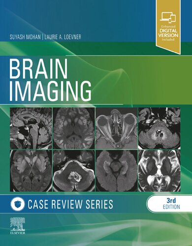 Brain Imaging: Case Review Series 3rd Edition (PDF/EPUB Version)
