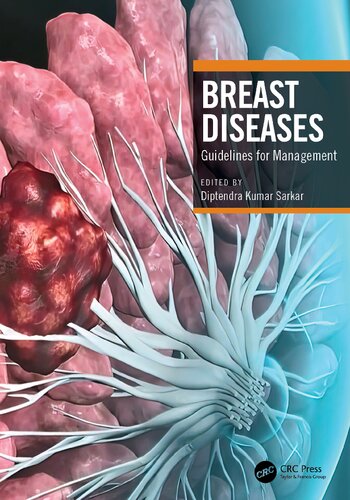 Breast Diseases: Guidelines for Management (PDF/EPUB Version)
