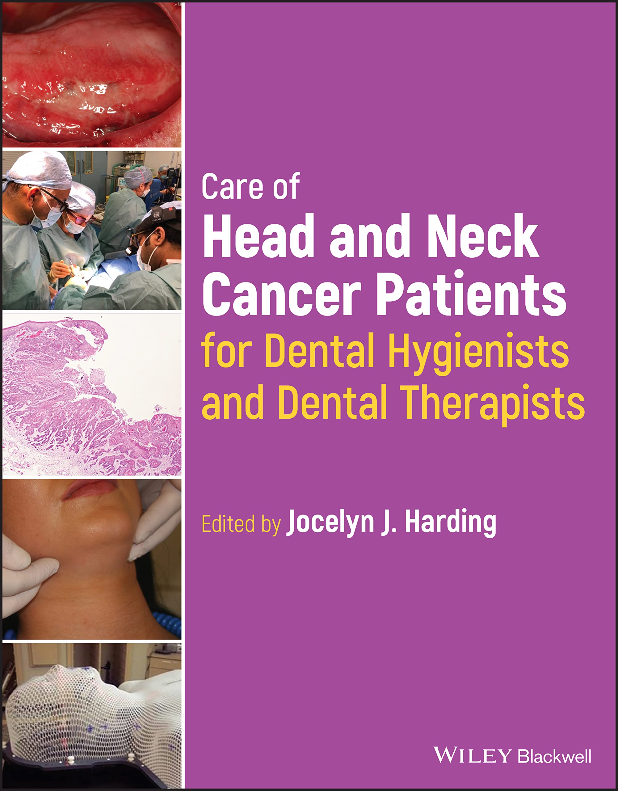 Care of Head and Neck Cancer Patients for Dental Hygienists and Dental Therapists (PDF/EPUB Version)
