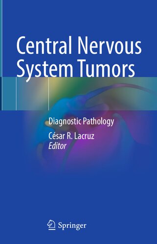 Central Nervous System Tumors: Diagnostic Pathology (PDF/EPUB Version)