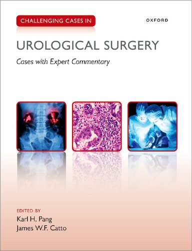 Challenging Cases in Urological Surgery (PDF/EPUB Version)
