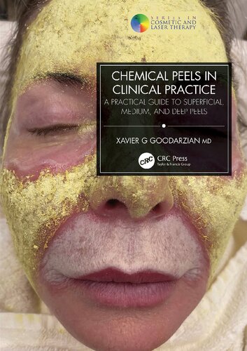 Chemical Peels in Clinical Practice: A Practical Guide to Superficial, Medium, and Deep Peels (Series in Cosmetic and Laser Therapy) (PDF/EPUB Version)
