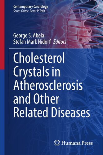 Cholesterol Crystals in Atherosclerosis and Other Related Diseases (Contemporary Cardiology) (PDF/EPUB Version)
