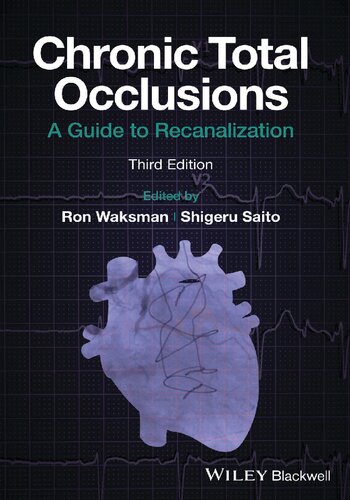 Chronic Total Occlusions: A Guide to Recanalization [Team-IRA] (PDF/EPUB Version)
