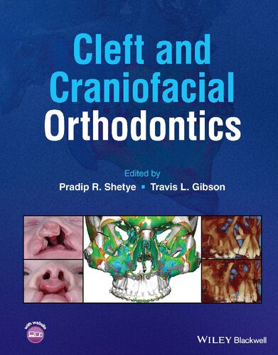 Cleft and Craniofacial Orthodontics (PDF/EPUB Version)
