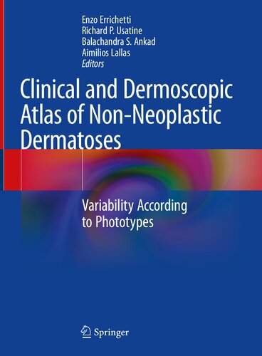 Clinical and Dermoscopic Atlas of Non-Neoplastic Dermatoses: Variability According to Phototypes (PDF/EPUB Version)
