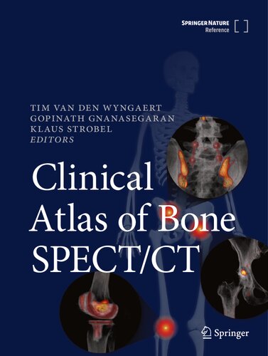 Clinical Atlas of Bone SPECT/CT (PDF/EPUB Version)