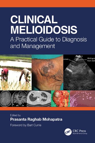 Clinical Melioidosis: A Practical Guide to Diagnosis and Management (PDF/EPUB Version)

