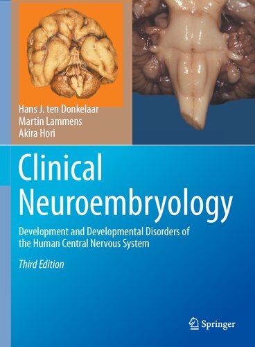 Clinical Neuroembryology: Development and Developmental Disorders of the Human Central Nervous System (PDF/EPUB Version)
