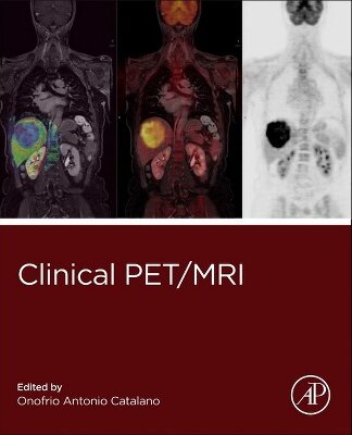 Clinical PET / MRI - Radiology Molecular Imaging (PDF/EPUB Version)
