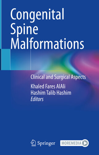 Congenital Spine Malformations: Clinical and Surgical Aspects (PDF/EPUB Version)