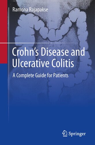 Crohn's Disease and Ulcerative Colitis: A Complete Guide for Patients (PDF/EPUB Version)
