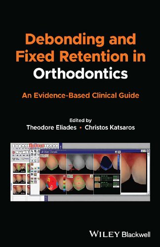 Debonding and Fixed Retention in Orthodontics: An Evidence-Based Clinical Guide [Team-IRA] (PDF/EPUB Version)
