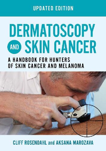 Dermatoscopy and Skin Cancer, updated edition: A handbook for hunters of skin cancer and melanoma [Team-IRA] (PDF/EPUB Version)
