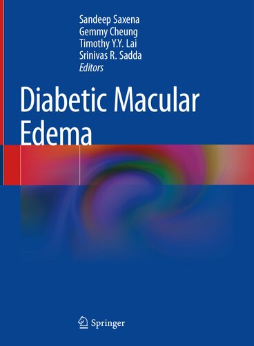 Diabetic Macular Edema (PDF/EPUB Version)
