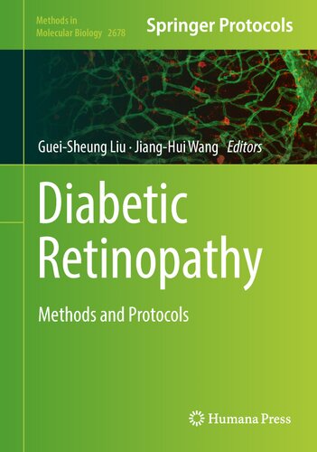 Diabetic Retinopathy: Methods and Protocols (Methods in Molecular Biology, 2678) (PDF/EPUB Version)
