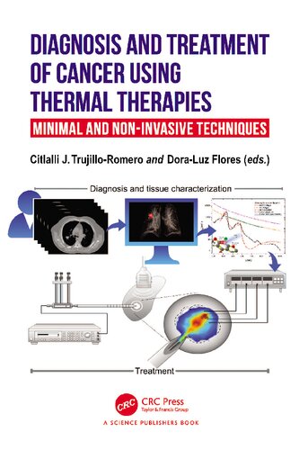 Diagnosis and Treatment of Cancer using Thermal Therapies: Minimal and Non-invasive Techniques [Team-IRA] (PDF/EPUB Version)
