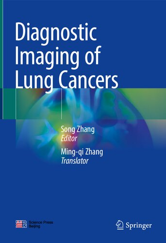 Diagnostic Imaging of Lung Cancers (PDF/EPUB Version)