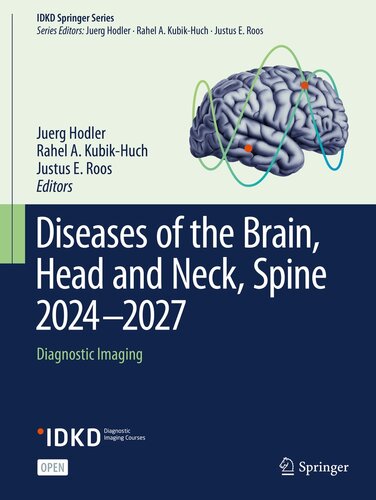 Diseases of the Brain, Head and Neck, Spine 2024-2027: Diagnostic Imaging (IDKD Springer Series) (PDF/EPUB Version)