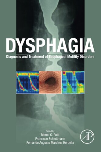 Dysphagia: Diagnosis and Treatment of Esophageal Motility Disorders (PDF/EPUB Version)
