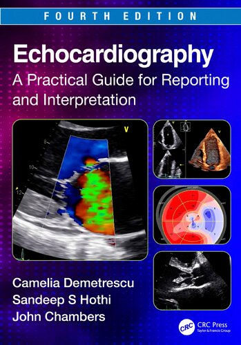 Echocardiography: A Practical Guide for Reporting and Interpretation (PDF/EPUB Version)
