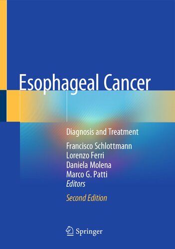 Esophageal Cancer: Diagnosis and Treatment (PDF/EPUB Version)
