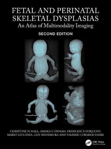 Fetal and Perinatal Skeletal Dysplasias: An Atlas of Multimodality Imaging (PDF/EPUB Version)