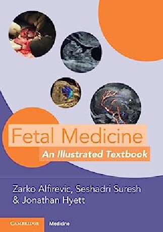 Fetal Medicine: An Illustrated Textbook (PDF/EPUB Version)

