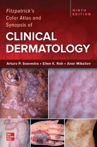 Fitzpatrick's Color Atlas and Synopsis of Clinical Dermatology, (PDF/EPUB Version)
