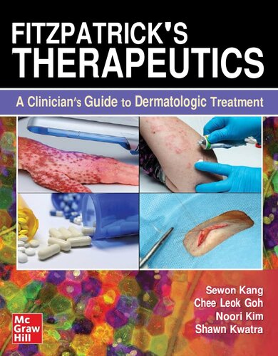 Fitzpatrick's Therapeutics: A Clinician's Guide to Dermatologic Treatment (PDF/EPUB Version)
