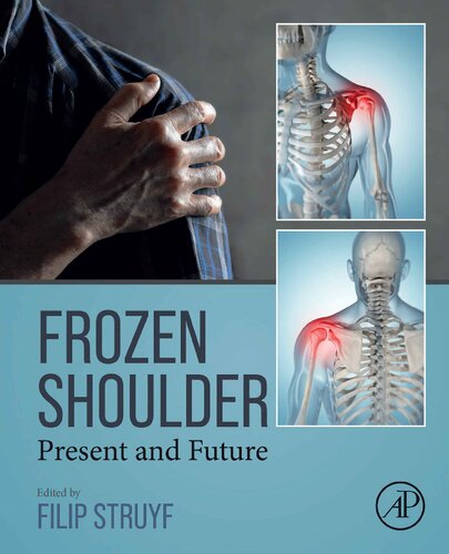 Frozen Shoulder: Present and Future (PDF/EPUB Version)