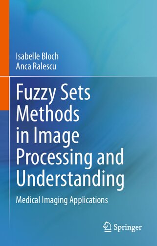 Fuzzy Sets Methods in Image Processing and Understanding: Medical Imaging Applications (PDF/EPUB Version)
