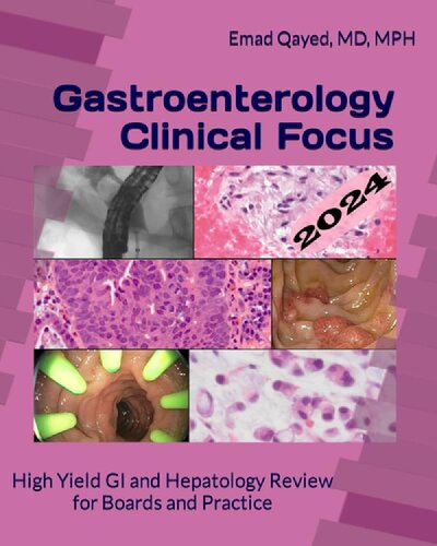 Gastroenterology Clinical Focus: High Yield GI And Hepatology Review For Boards And Practice (PDF/EPUB Version)