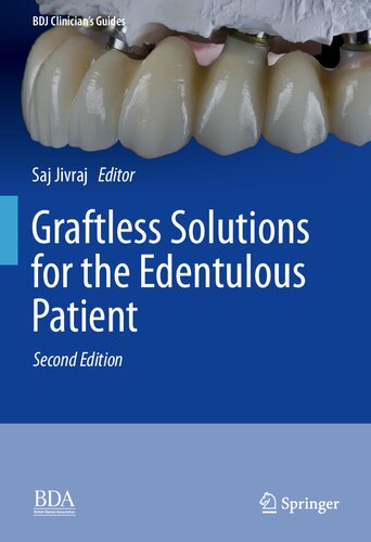 Graftless Solutions for the Edentulous Patient (BDJ Clinician’s Guides) (PDF/EPUB Version)

