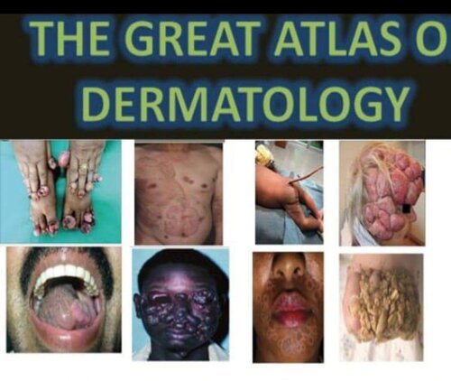great atlas of dermatology indexed (PDF/EPUB Version)
