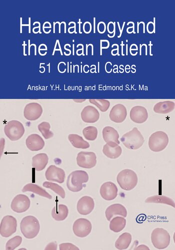 Haematology and the Asian Patient: 51 Clinical Cases (PDF/EPUB Version)