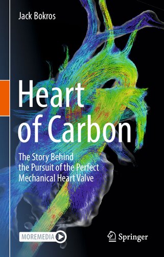 Heart of Carbon: The Story Behind the Pursuit of the Perfect Mechanical Heart Valve (PDF/EPUB Version)
