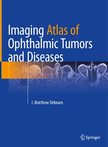 Imaging Atlas of Ophthalmic Tumors and Diseases (PDF/EPUB Version)
