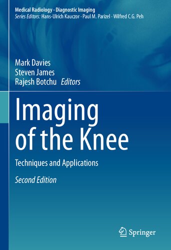 Imaging of the Knee: Techniques and Applications (PDF/EPUB Version)
