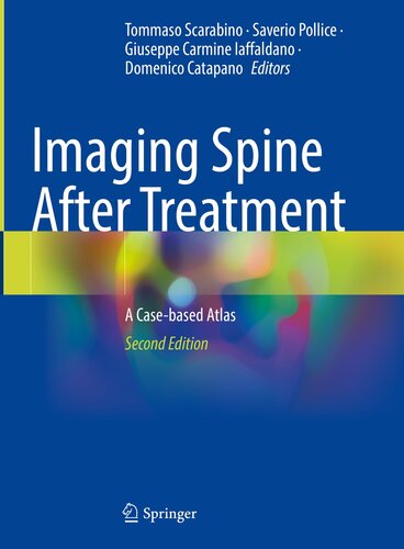 Imaging Spine After Treatment: A Case-based Atlas (PDF/EPUB Version)