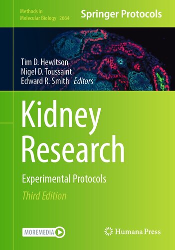 Kidney Research: Experimental Protocols (Methods in Molecular Biology, 2664) (PDF/EPUB Version)
