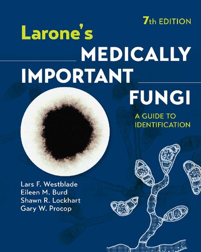 Larone's Medically Important Fungi: A Guide to Identification [Team-IRA] (PDF/EPUB Version)
