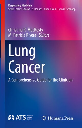 Lung Cancer: A Comprehensive Guide for the Clinician (Respiratory Medicine) (PDF/EPUB Version)
